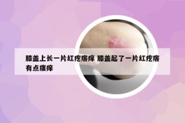 膝蓋上長一片紅疙瘩癢 膝蓋起了一片紅疙瘩有點瘙癢