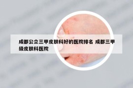 成都公立三甲皮膚科好的醫(yī)院排名 成都三甲級皮膚科醫(yī)院