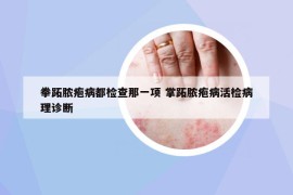 拳跖膿皰病都檢查那一項(xiàng) 掌跖膿皰病活檢病理診斷