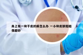身上有一塊干皮的癬怎么辦 一小塊皮膚粗糙像磨砂