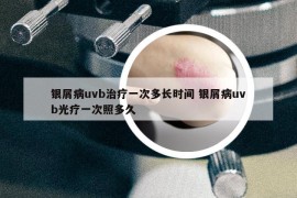 銀屑病uvb治療一次多長時(shí)間 銀屑病uvb光療一次照多久