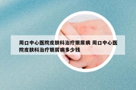 周口中心醫(yī)院皮膚科治療銀屑病 周口中心醫(yī)院皮膚科治療銀屑病多少錢