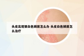頭皮出現(xiàn)銀白色鱗屑怎么辦 頭皮白色鱗屑怎么治療