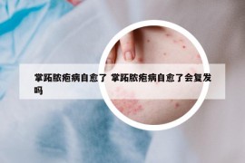 掌跖膿皰病自愈了 掌跖膿皰病自愈了會復(fù)發(fā)嗎