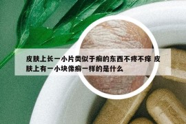 皮膚上長一小片類似于癬的東西不疼不癢 皮膚上有一小塊像癬一樣的是什么