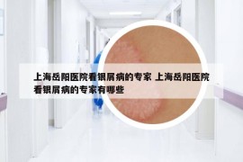 上海岳陽醫(yī)院看銀屑病的專家 上海岳陽醫(yī)院看銀屑病的專家有哪些