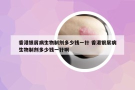 香港銀屑病生物制劑多少錢一針 香港銀屑病生物制劑多少錢一針啊