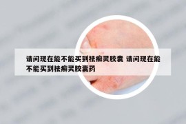 請問現(xiàn)在能不能買到祛癬靈膠囊 請問現(xiàn)在能不能買到祛癬靈膠囊藥