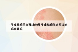 牛皮膚癬羊肉可以吃嗎 牛皮膚癬羊肉可以吃嗎有毒嗎