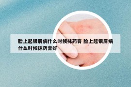 臉上起銀屑病什么時候抹藥膏 臉上起銀屑病什么時候抹藥膏好