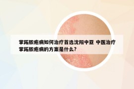 掌跖膿皰病如何治療首選沈陽中亞 中醫(yī)治療掌跖膿皰病的方案是什么?