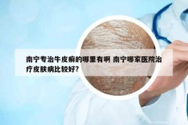 南寧專治牛皮癬的哪里有啊 南寧哪家醫(yī)院治療皮膚病比較好?