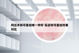 阿達(dá)木和可善挺哪一種好 拓咨和可善挺效果對比