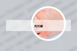 片行癬