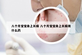 八個月寶寶身上長癬 八個月寶寶身上長癬用什么藥