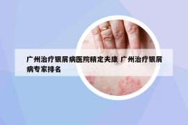 廣州治療銀屑病醫(yī)院精定夫康 廣州治療銀屑病專家排名