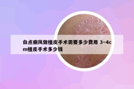 白點(diǎn)癲風(fēng)做植皮手術(shù)需要多少費(fèi)用 3～4cm植皮手術(shù)多少錢