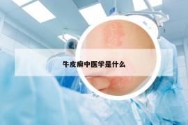 牛皮癬中醫(yī)學(xué)是什么