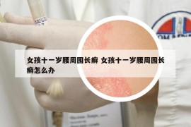 女孩十一歲腰周圍長癬 女孩十一歲腰周圍長癬怎么辦