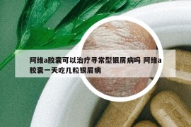 阿維a膠囊可以治療尋常型銀屑病嗎 阿維a膠囊一天吃幾粒銀屑病
