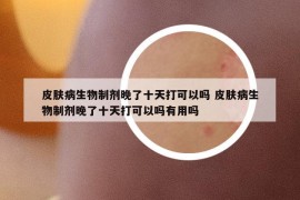 皮膚病生物制劑晚了十天打可以嗎 皮膚病生物制劑晚了十天打可以嗎有用嗎