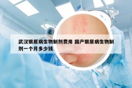 武漢銀屑病生物制劑費用 國產(chǎn)銀屑病生物制劑一個月多少錢