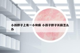 小孩脖子上有一小塊癬 小孩子脖子長蘚怎么辦
