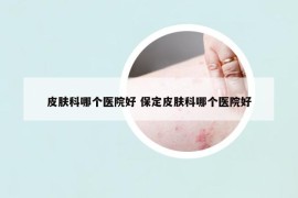 皮膚科哪個醫(yī)院好 保定皮膚科哪個醫(yī)院好