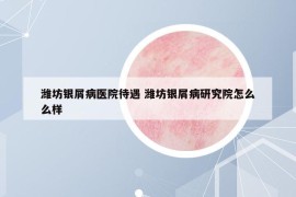 濰坊銀屑病醫(yī)院待遇 濰坊銀屑病研究院怎么么樣