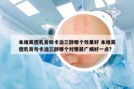 本維莫德乳膏和卡泊三醇哪個效果好 本維莫德乳膏與卡泊三醇哪個對銀屑廣病好一點?
