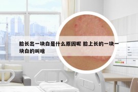 臉長出一塊白是什么原因呢 臉上長的一塊一塊白的叫啥