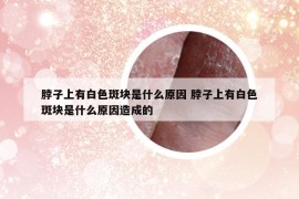 脖子上有白色斑塊是什么原因 脖子上有白色斑塊是什么原因造成的