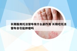 長期服用托法替布有什么副作用 長期吃托法替布會(huì)引起腫瘤嗎