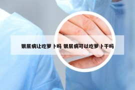 銀屑病讓吃蘿卜嗎 銀屑病可以吃蘿卜干嗎