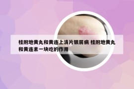 桂附地黃丸和黃連上清片銀屑病 桂附地黃丸和黃連素一塊吃的作用