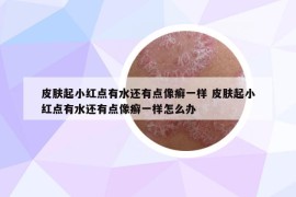 皮膚起小紅點有水還有點像癬一樣 皮膚起小紅點有水還有點像癬一樣怎么辦