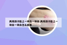 兩周孩子臉上一塊白一塊白 兩周孩子臉上一塊白一塊白怎么回事