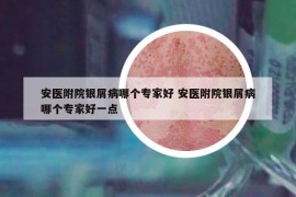安醫(yī)附院銀屑病哪個專家好 安醫(yī)附院銀屑病哪個專家好一點