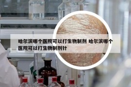 哈爾濱哪個醫(yī)院可以打生物制劑 哈爾濱哪個醫(yī)院可以打生物制劑針