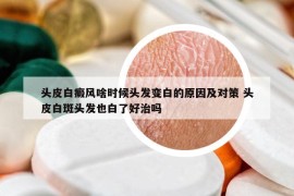 頭皮白癜風(fēng)啥時(shí)候頭發(fā)變白的原因及對策 頭皮白斑頭發(fā)也白了好治嗎