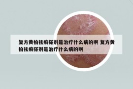 復(fù)方黃柏祛癬搽劑是治療什么病的啊 復(fù)方黃柏祛癬搽劑是治療什么病的啊