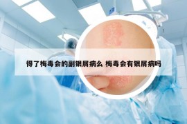 得了梅毒會(huì)的副銀屑病么 梅毒會(huì)有銀屑病嗎