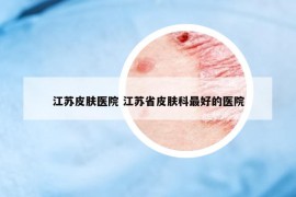 江蘇皮膚醫(yī)院 江蘇省皮膚科最好的醫(yī)院