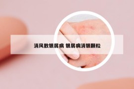 消風(fēng)散銀屑病 銀屑病消銀顆粒