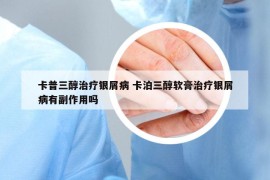 卡普三醇治療銀屑病 卡泊三醇軟膏治療銀屑病有副作用嗎