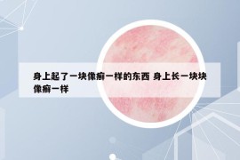 身上起了一塊像癬一樣的東西 身上長(zhǎng)一塊塊像癬一樣