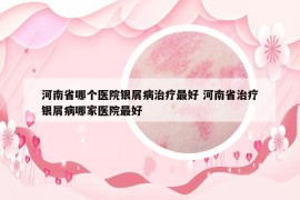 河南省哪個醫(yī)院銀屑病治療最好 河南省治療銀屑病哪家醫(yī)院最好