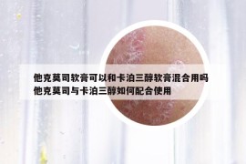 他克莫司軟膏可以和卡泊三醇軟膏混合用嗎 他克莫司與卡泊三醇如何配合使用