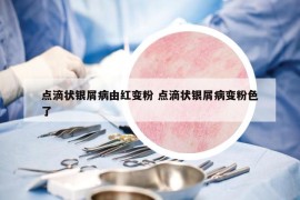 點滴狀銀屑病由紅變粉 點滴狀銀屑病變粉色了