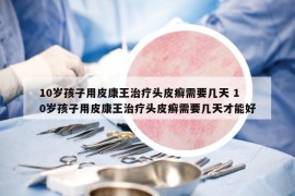 10歲孩子用皮康王治療頭皮癬需要幾天 10歲孩子用皮康王治療頭皮癬需要幾天才能好
